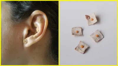 ईयर सीडिंग के बारे में जानें सब कुछ  ear seeding benefits