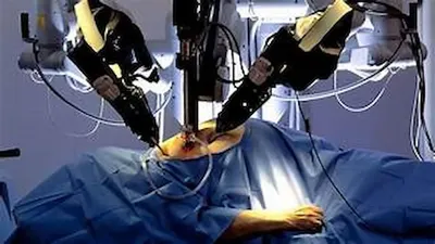 यूरोलॉजिकल समस्याओं में वरदान साबित हो रही रोबोटिक सर्जरी  robotic surgery
