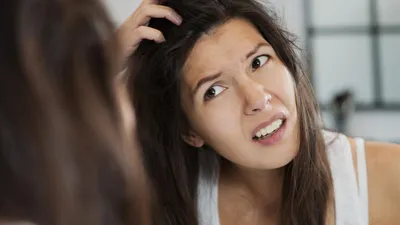 बाल में हो गयी हैं जुएं  तो ये 8 घरेलू उपचार आएंगे काम  head lice remedy