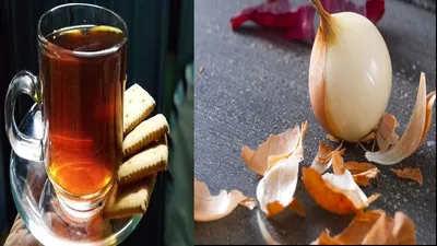 प्याज के छिलके की बनी चाय के फायदे जानकर रह जाएंगे हैरान  onion peel tea benefits