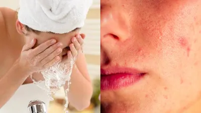 सेंसिटिव स्किन पर नहीं होगी जलन  इन 7 टिप्स को करें फॉलो  skin care tips