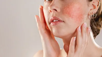 सर्दी में सेंसिटिव त्वचा पर नहीं होगी जलन  इन टिप्स को करें ट्राई  sensitive skin care tips