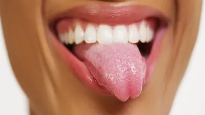 जीभ है हमारी सेहत का आइना  tongue health
