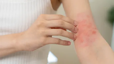 लापरवाही का नतीजा है ये 3 त्वचा सम्बन्धी बीमारियां  reason of skin allergies