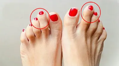 आपके पैर की दूसरी उंगली अंगूठे से बड़ी है तो आपके अंदर हैं ये खूबियां  foot fingers astrology