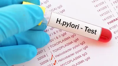 सावधान  एच  पाइलोरी बैक्टीरिया ने किया हमला तो हो सकता है पेट के कैंसर  h  pylori infection