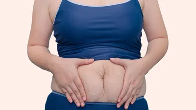 डिलीवरी के बाद लटकती पेट की चर्बी को कम करने के लिए करें ये योगासन  belly fat yoga