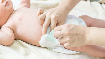 baby diaper  डायपर पहनाना कितना है सुरक्षित  जानें इसकी एबीसीडी