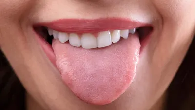 जीभ होती है सेहत का आईना  देती है कई बिमारियों के संकेत  tongue color and health