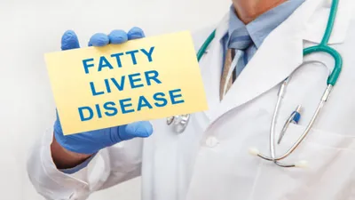 जानिए फैटी लिवर की समस्या से बचने के लिए क्या खाएं और किन चीजों से रहें दूर  fatty liver diet
