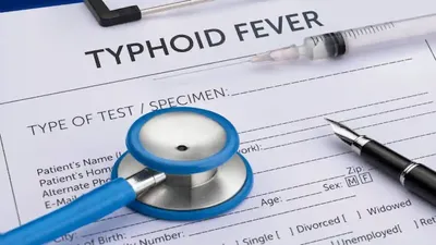 टाइफाइड कितने दिन तक रहता है और क्या हैं इसके लक्षण  जानिए  typhoid fever